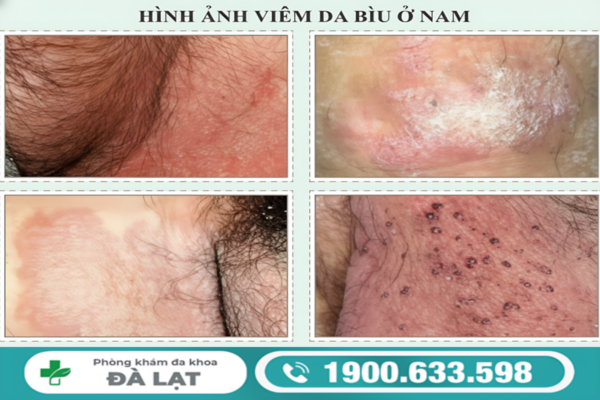 Hình ảnh minh họa